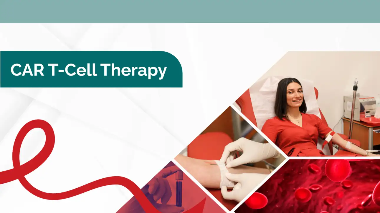 CAR T-Cell Therapy